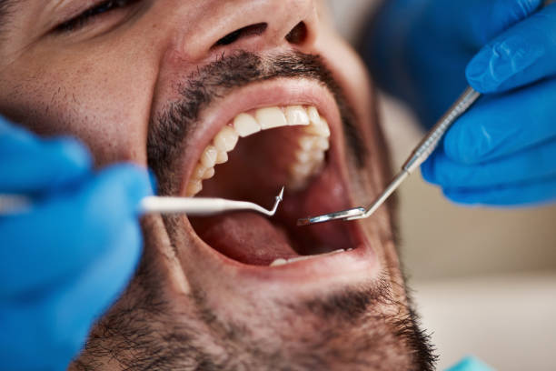 Best Root Canal Emergency Dentist  in Ceredo, WV